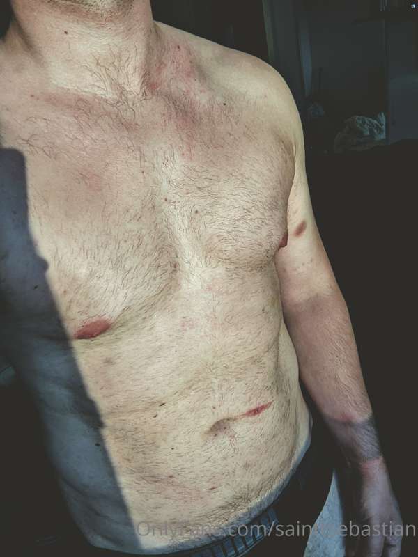It's called recovery. Don't ask me where the bruises, the hi..