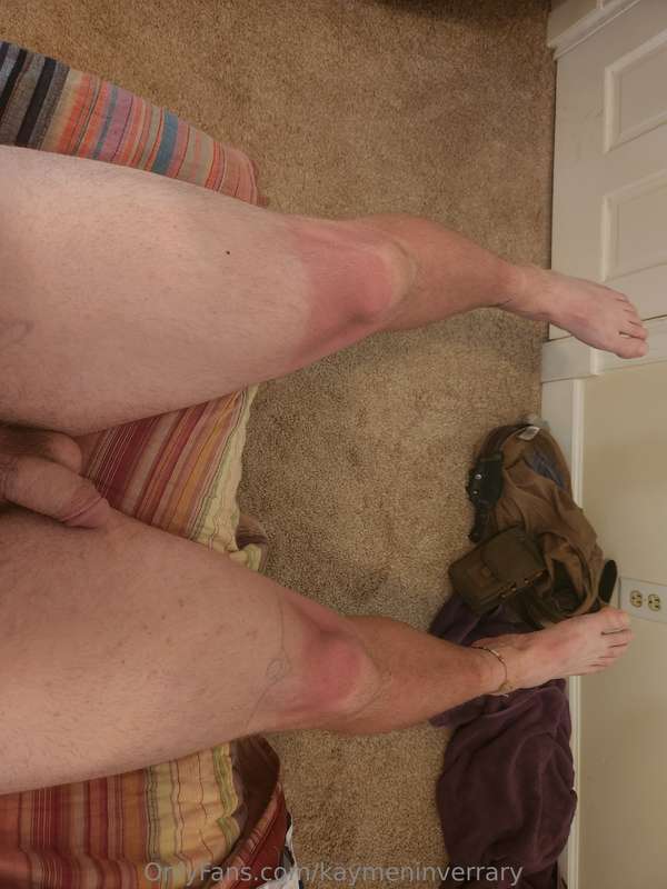 Damn i got burnt. 1