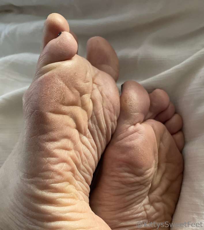 My feet have been through a lot! These wrinkled, dry soles a..