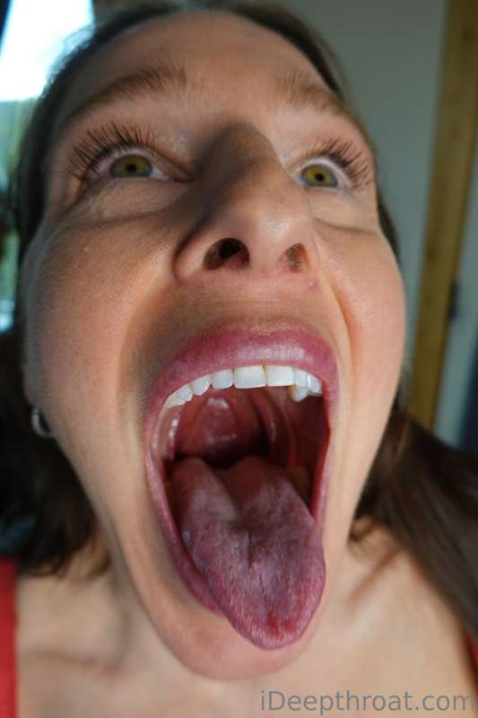 My mouth seems to me a hot topic. Here are some closeups of .. 3