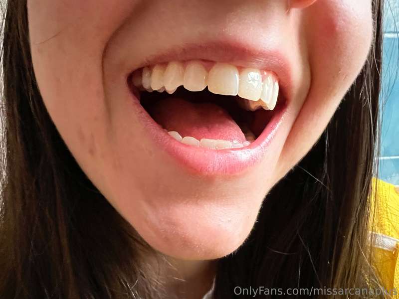 (1-12) I'm ready for my remote dental exam ahhhhhhhhhh
This .. 2