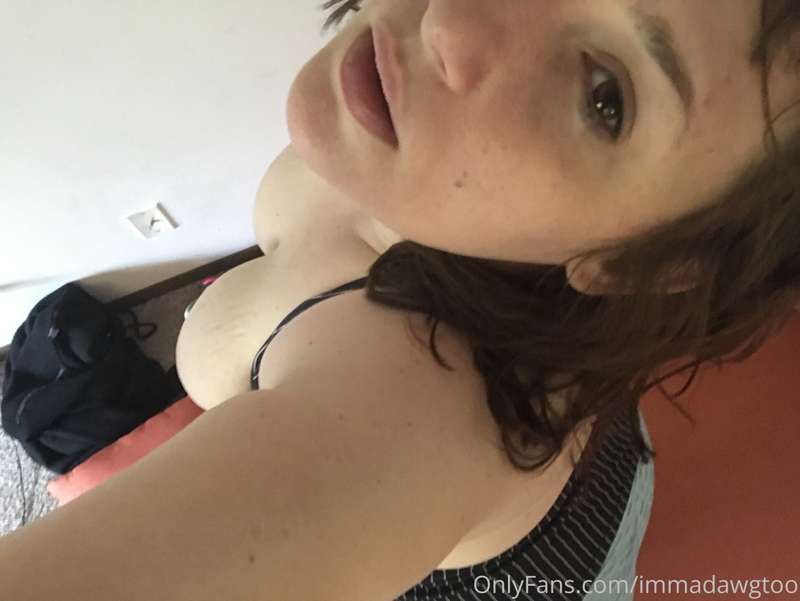 😘 25
