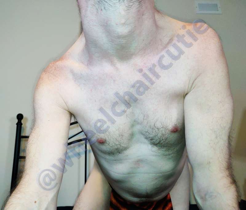 Wheelchaircutie - Fansly - 09 Aug, 2022 3