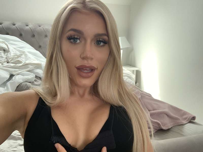 First look at my new boobs! Still need to wear the support b.. 4