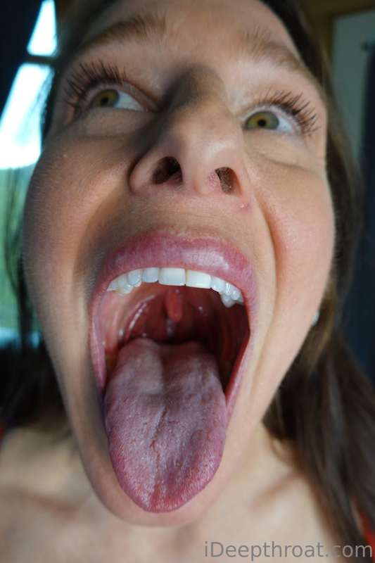 My mouth seems to me a hot topic. Here are some closeups of .. 1