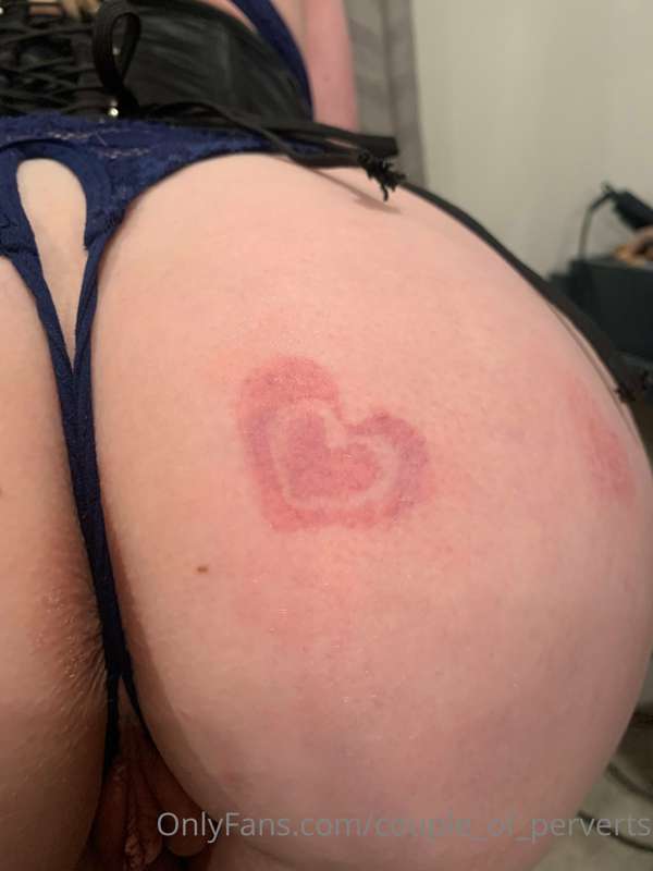 They don’t look like much, but they sure do sting and leave .. 2
