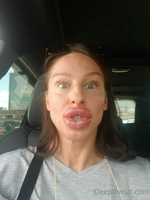 If you guessed "lip filler" you are part correct. I actually..