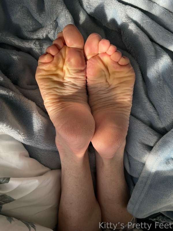Kissed by sunshine 5