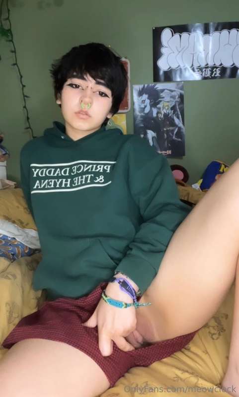 hey gaymers, I found out that i’m allergic to dogs ); my eye.. 8
