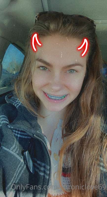Last selfies with braces on 🥺💓 & vid of them coming off! I’m..