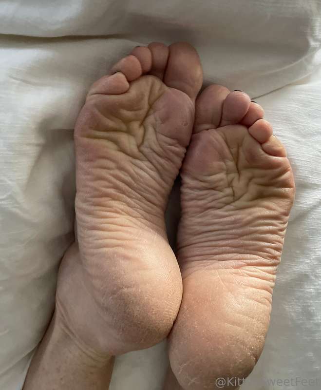 My feet have been through a lot! These wrinkled, dry soles a.. 8