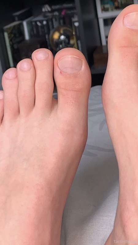 Some closeups 🧐 got a little cut on my big toe sorry 🌝 1