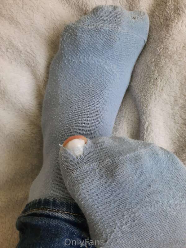 I see my toe wants attention. Now I'm going to take care of .. 2
