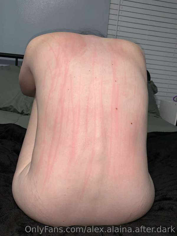 Look at those scratches!

I enjoy the rush of excitement whe..