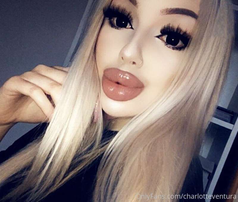 😘