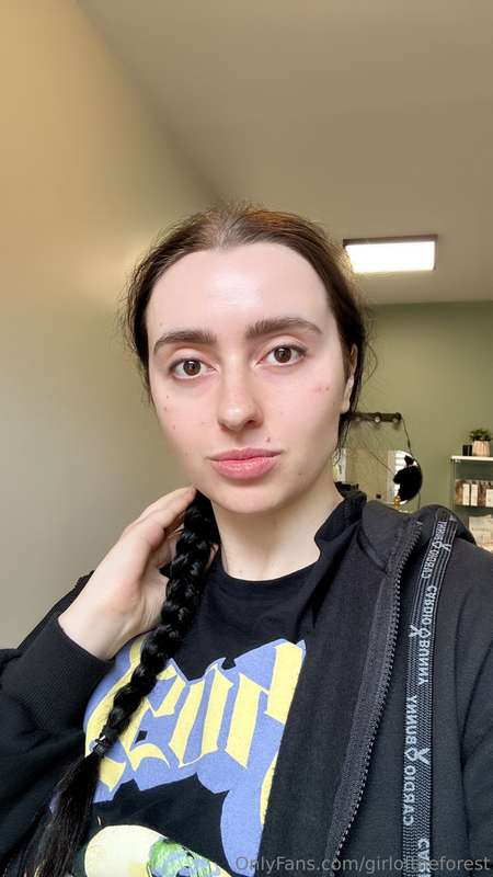 Guys, I got facial injections!!!I chose a product called POL..