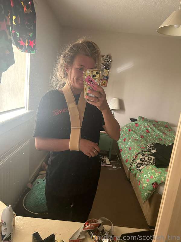 dislocated my shoulder yesterday b4 my date / I’ve also torn..