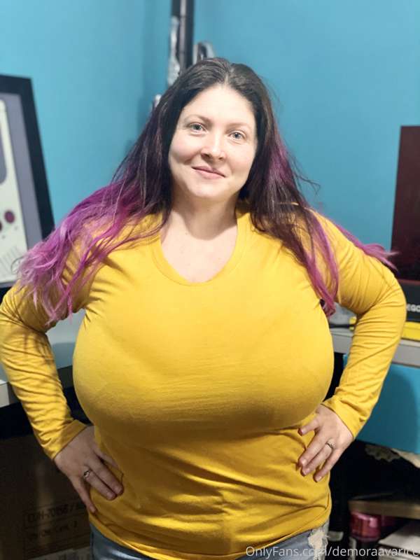 So yea. Definitely going with another fat transfer. Also goa.. 6
