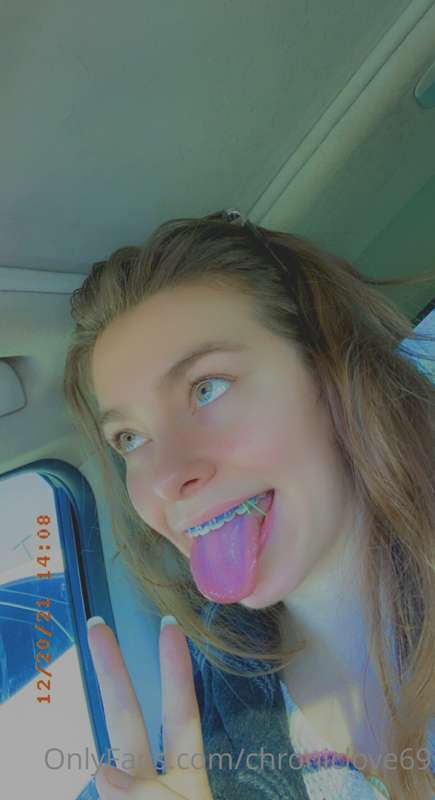 Last selfies with braces on 🥺💓 & vid of them coming off! I’m.. 5