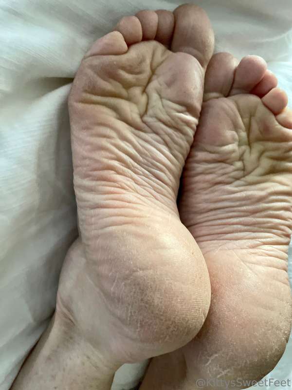 My feet have been through a lot! These wrinkled, dry soles a.. 1