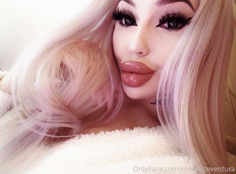 kisses
