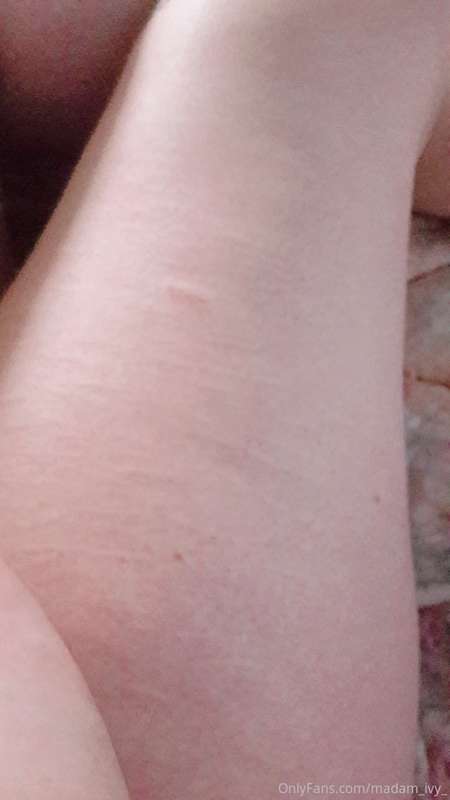Tw. Self harm scars

.
 
. 

.


So these pics have angles, .. 4