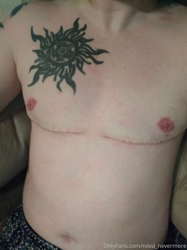 Update as to why I was gone? I had top surgery and was recov..