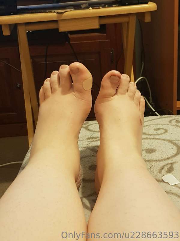 By no means the start of my amputation journey (It was a 2 y..