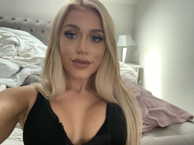 First look at my new boobs! Still need to wear the support b.. 5