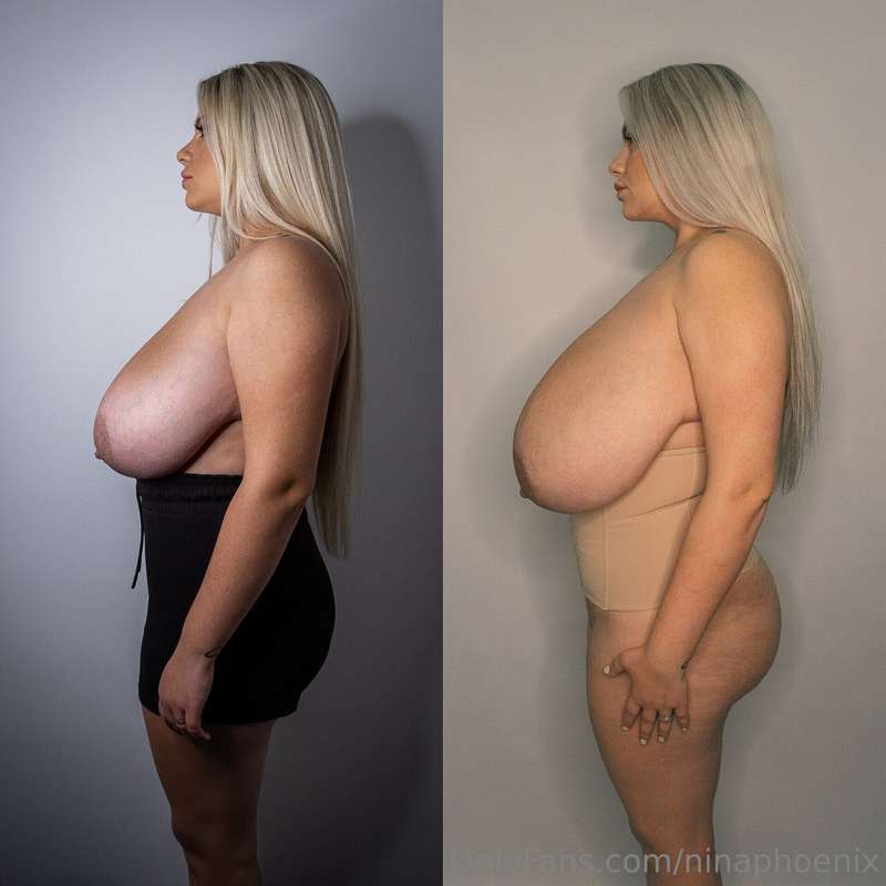 2021. vs 2025.The rest of my body is almost the same. 🥰 I lo..