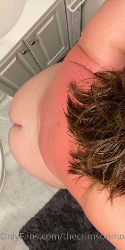 Mommy may have spent a little too much time in the sun today.. 3