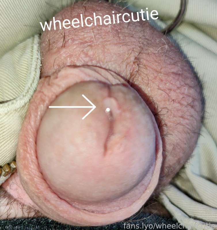 Wheelchaircutie - Fansly - 31 Aug, 2021