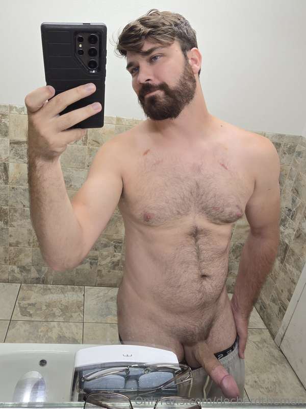Look at all these bite marks! (Bonus sfw selfie)