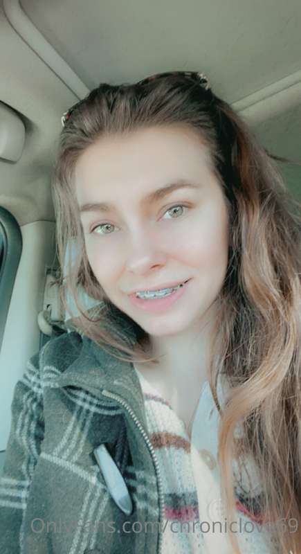 Last selfies with braces on 🥺💓 & vid of them coming off! I’m.. 2