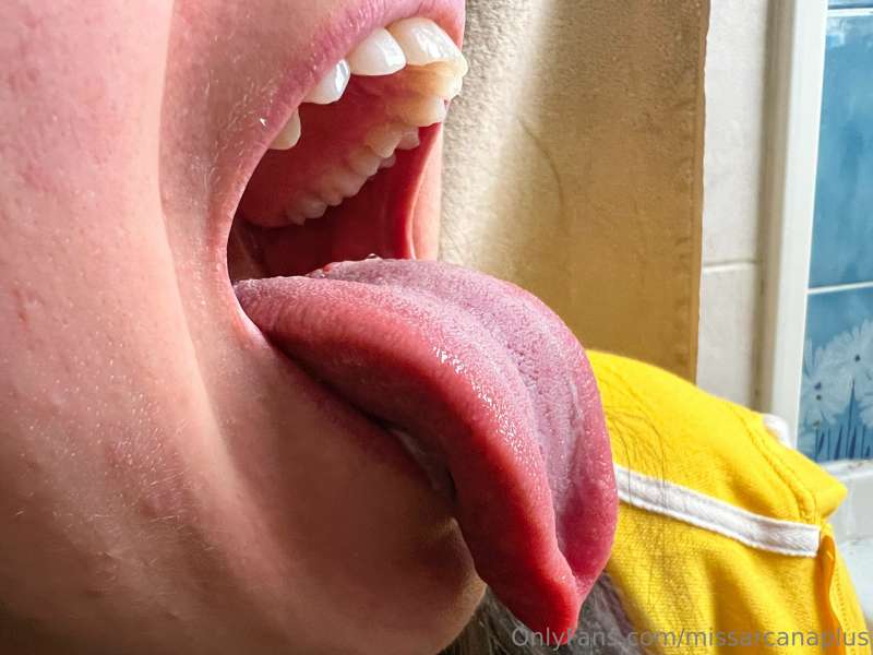 (1-12) I'm ready for my remote dental exam ahhhhhhhhhh
This .. 8