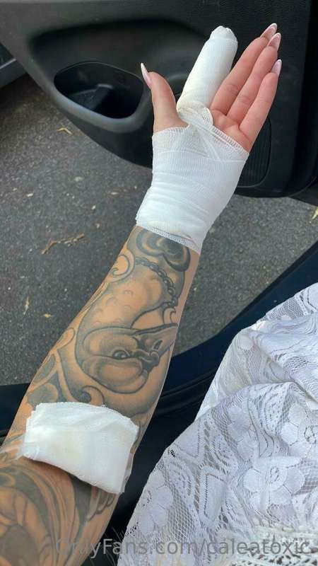 Unfortunately, I had to go to the hospital yesterday evening..