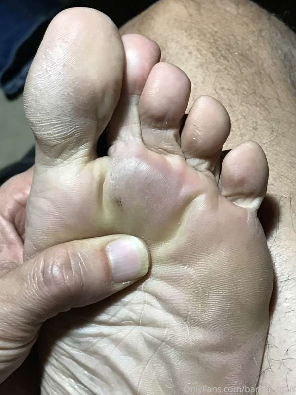 Leathery soles.