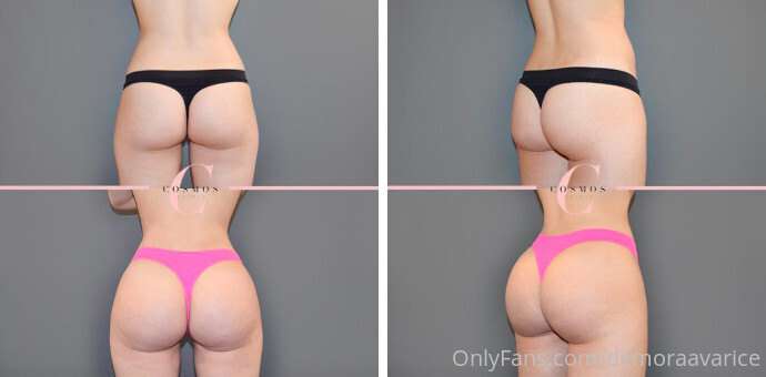 The surgeon wants me to send “wish list” pics of butts... an..