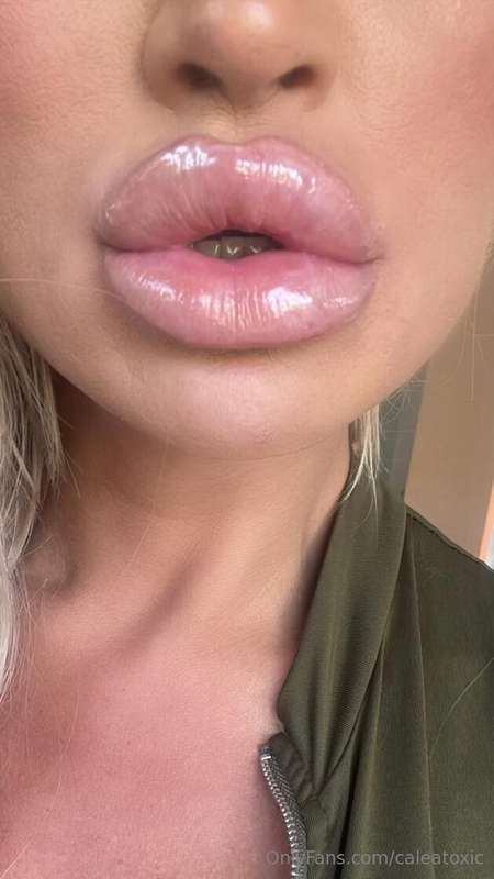 I have finally had my lips injected again. I love the feelin.. 1