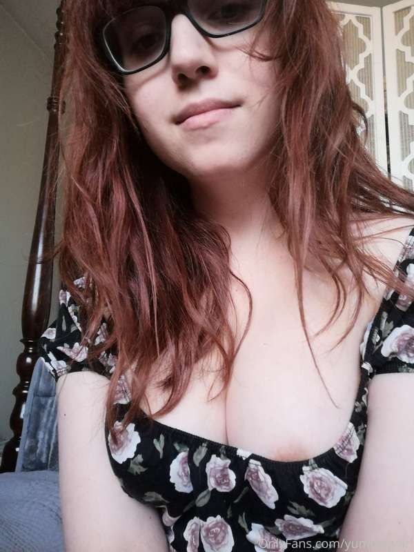 No make up after laser photos! I would take more but I ran o.. 3
