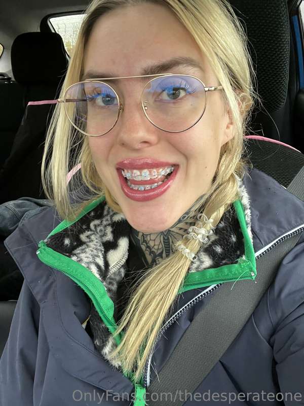 Hopefully somebody’s got a kink for braces ;)