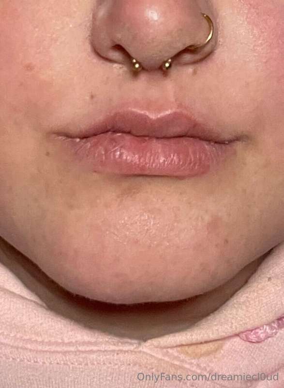 Ough a lil video of me getting my lips plumped! First look 🌸..