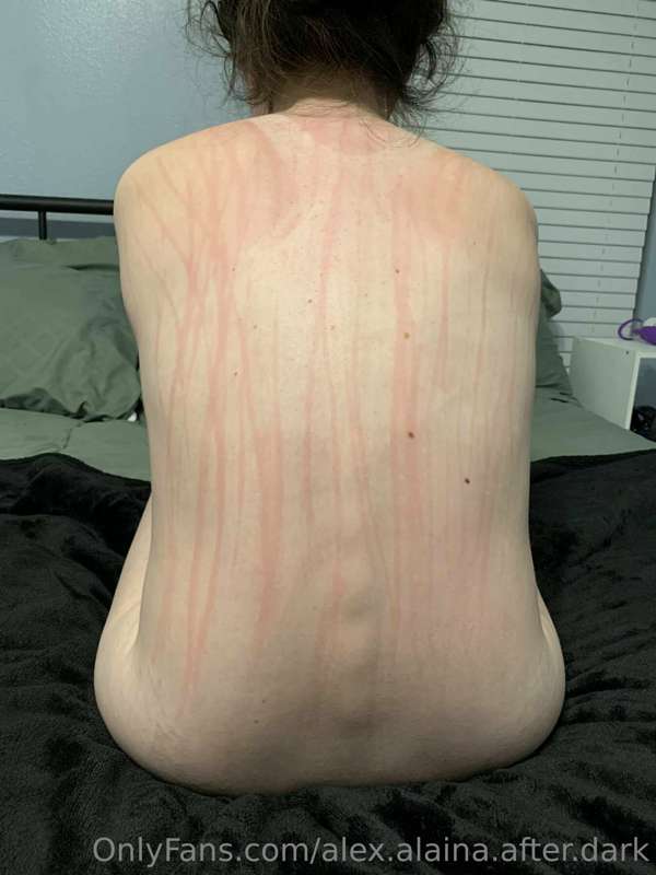 Look at those scratches!

I enjoy the rush of excitement whe.. 2