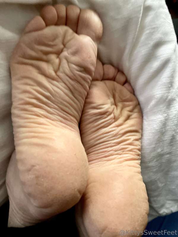 My feet have been through a lot! These wrinkled, dry soles a.. 6