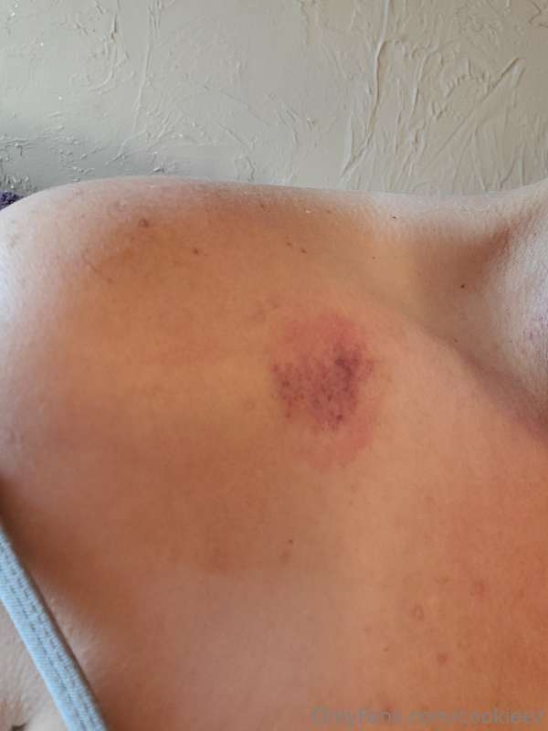 Would you leave marks like this on me? 😏😈😏 Please!